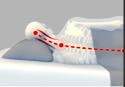 Illustration of a person resting on a lower, conventional pillow profile